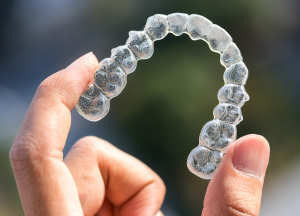 Achieve Your Smile Goals With Calgary Invisalign!