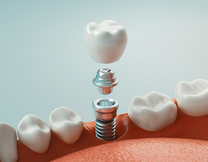 Dental care, modern clinic, 3d rendering